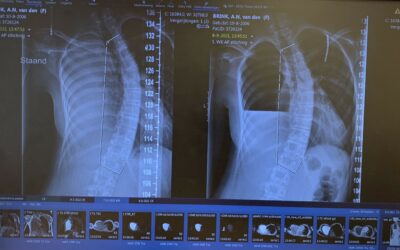 8 februari 2022Gesprek orthopeed Vergroessen